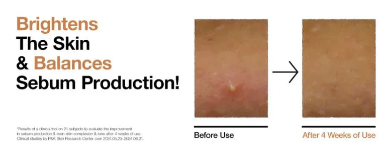 ANUA-70 GLOW MILKY TONER 250ml - Image 4