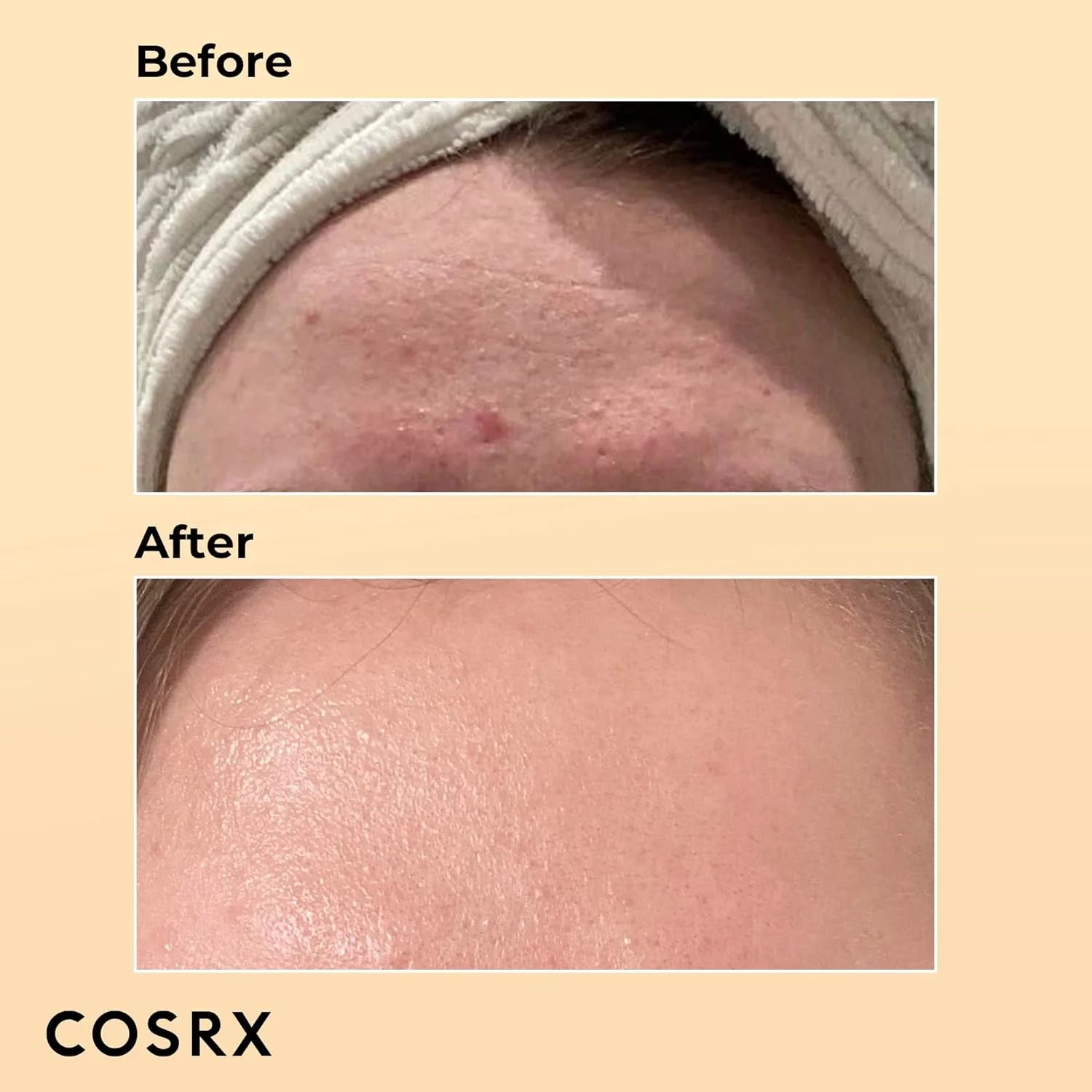 COSRX Advanced Snail 96 Mucin Power Essence - 100ml - Image 7