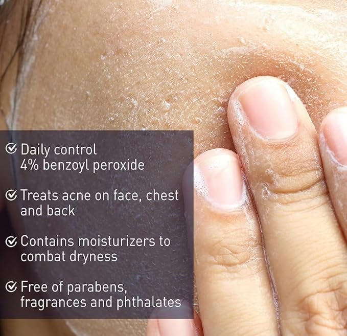 Panoxyl AM Oil Control Moisturizer 1.7oz - Image 4